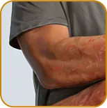 Photos representing the organs most commonly involved at baseline among patients in the AGAVE-201 trial: skin, lungs, and joints/fascia.